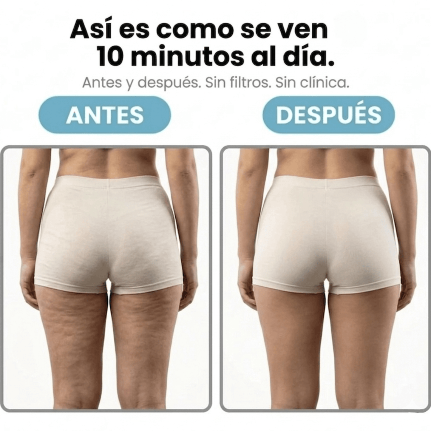 Masajeador Rotatorio AntiCelulitis - MySelora™