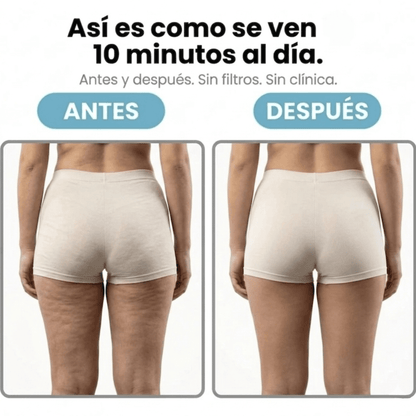 Masajeador Rotatorio AntiCelulitis - MySelora™